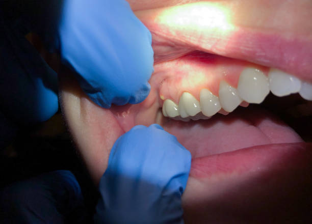 Best Mobile Emergency Dentist in Corralitos, CA